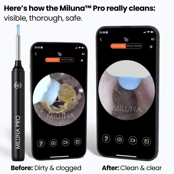 Ear Wax Removal Tool With Camera