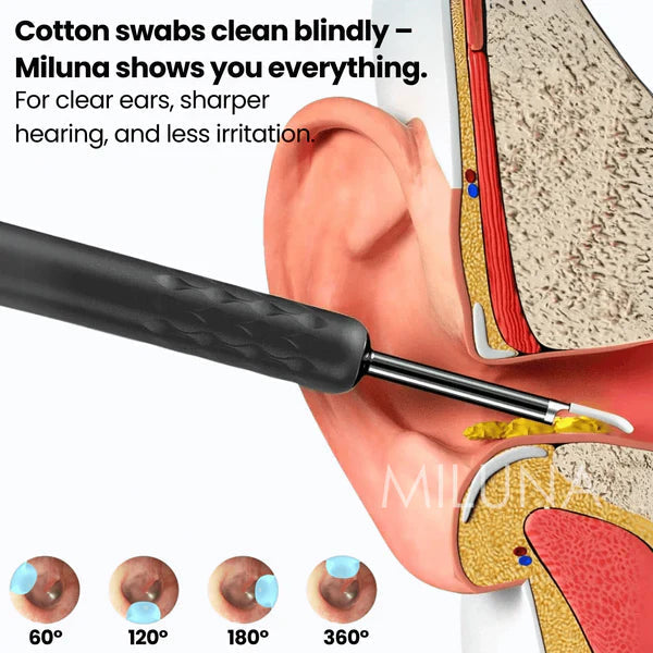 Ear Wax Removal Tool With Camera
